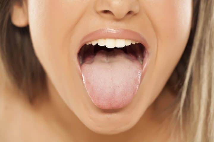 how to heal burnt tongue