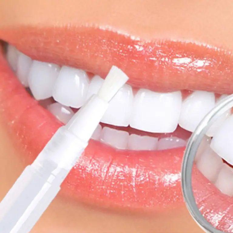 How to remove stains from teeth